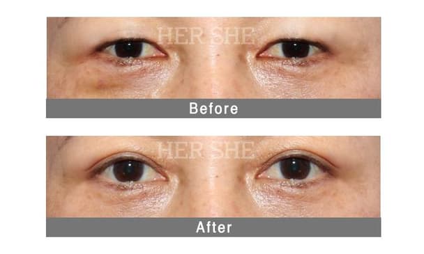 Slider image (4) HERSHE Plastic Surgery Dermatology Aesthetic Care Clinic